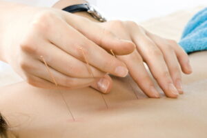 Acupuncture gone wrong negligence compensation claims