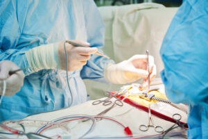 Anaesthetic Negligence Compensation Claims