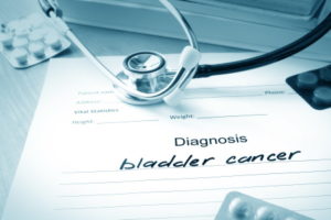 Bladder Cancer Medical Negligence