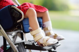 Cerebral palsy medical negligence compensation claims guide