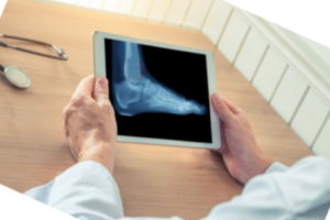 Missed calcaneus fracture compensation claims
