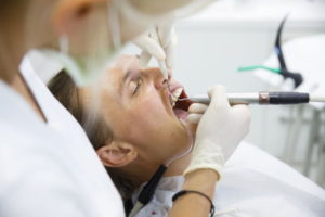 Missed tooth fracture compensation claims