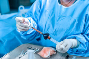 cosmetic surgery claims medical negligence
