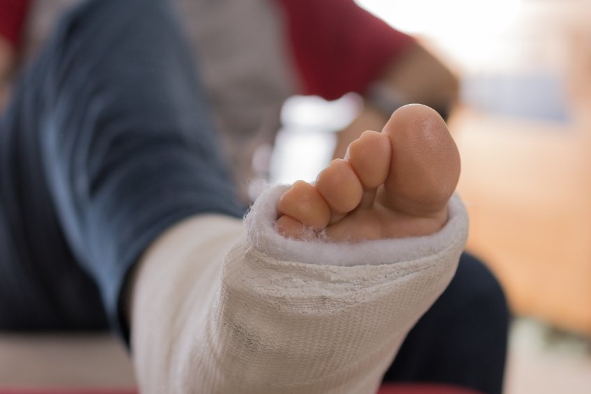 delayed toe fracture diagnosis